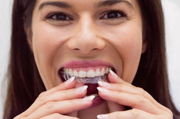 WHY SHOULD YOU CHOOSE INVISALIGN?