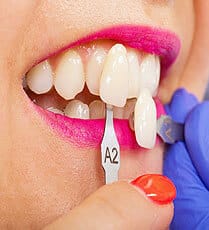 img-Color-Of-Your-Teeth img-Color-Of-Your-Teeth