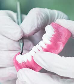 img-Implant-Supported-Denture_img3 img-Implant-Supported-Denture_img3