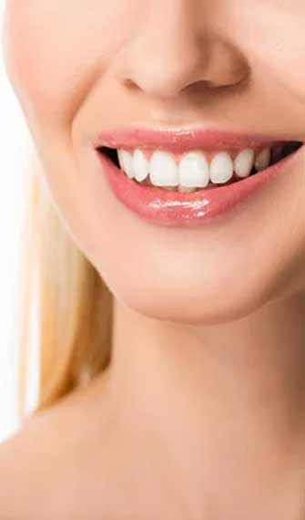 teeth-whitening-img (1)