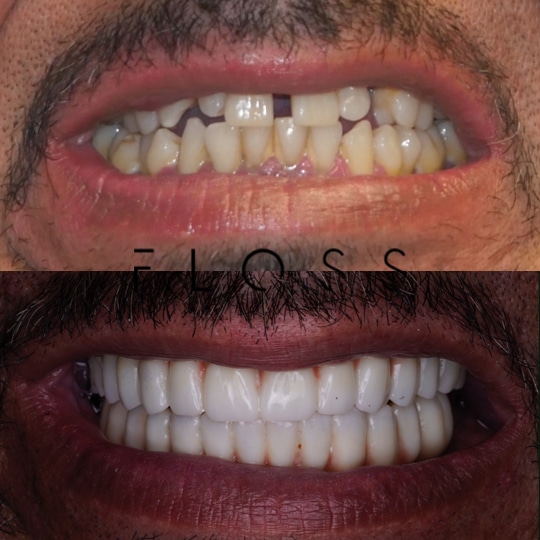 before_after_8 before_after_8