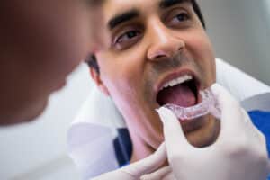 invisalign dentist in houston tx, floss dental of houston midtown