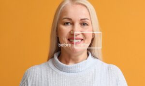 cosmetic dentist in houston, tx