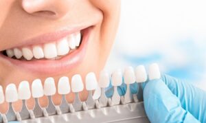 Teeth Whitening in Houston TX, FLOSS Dental of Houston Midtown