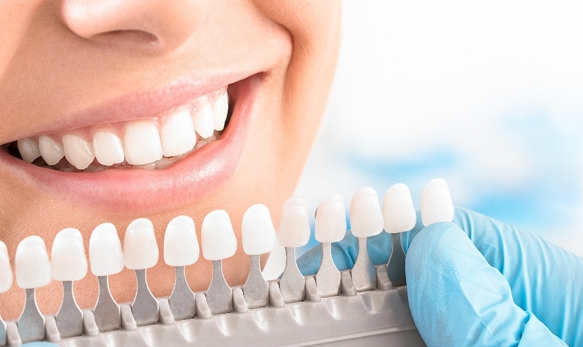 Teeth Whitening Tips for Busy Professionals, Parents, and Students