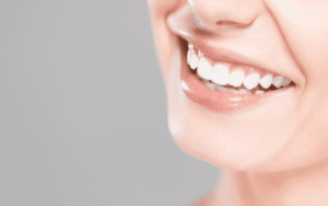 Natural Vs. Professional Teeth Whitening