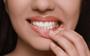 When to Seek Periodontal Service