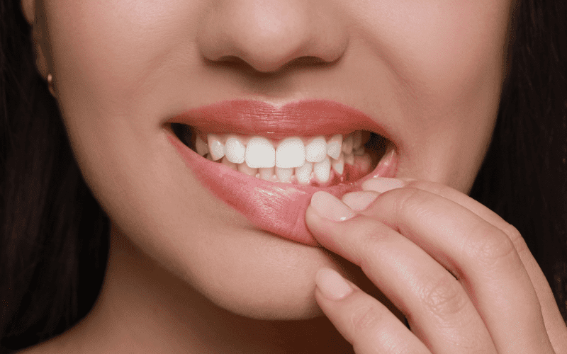 When to Seek Periodontal Service