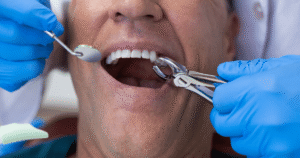 Healing After a Tooth Extraction_ How to Care for Your Mouth Post-Surgery
