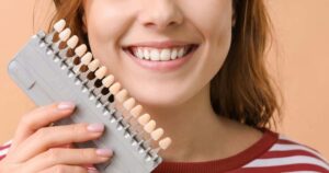how to choose the perfect shade for your veneers