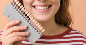 common issues with dental veneers and how to fix them