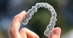 role of lifestyle in your invisalign journey